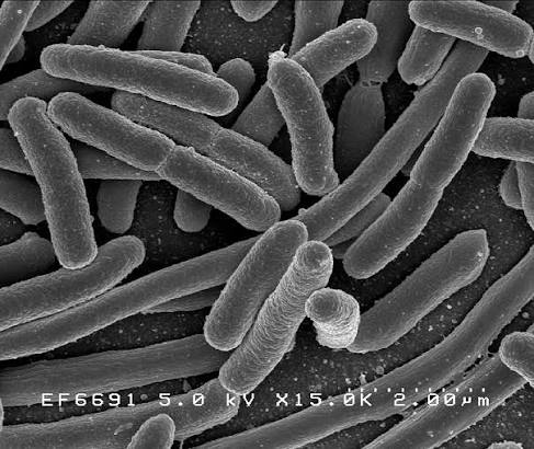 Batteri E. coli al microscopio elettronico